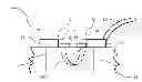 Fig. 01 - Acoustic methods for sensor communication
