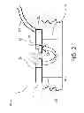 Fig. 03 - Acoustic methods for sensor communication