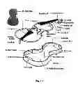 Fig. 02 - Elements to improve the sound quality of stringed musical instruments
