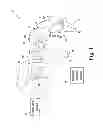 Fig. 02 - ORAL SUCTION DEVICE WITH VENTILATION CAPABILITY