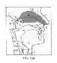 Fig. 02 - NASAL ADMINISTRATION