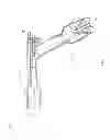 Fig. 11 - Respiratory therapy device and filtration units therefor