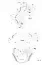 Fig. 03 - Mask bead for patient interface