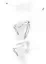 Fig. 04 - Mask bead for patient interface
