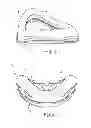 Fig. 03 - Cushion for patient interface