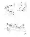 Fig. 22 - Cushion for patient interface