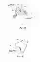 Fig. 40 - Cushion for patient interface
