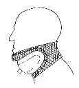 Fig. 01 - Device and method for opening an airway
