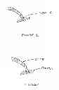 Fig. 02 - Device and method for opening an airway