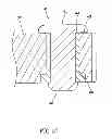 Fig. 10 - Floss holder