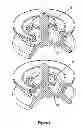 Fig. 05 - Tunable fluid end