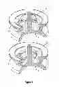 Fig. 05 - Tunable fluid end