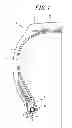 Fig. 02 - Pneumatic tire with specified bead core and method for manufacturing the same