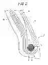 Fig. 03 - Pneumatic tire with specified bead core and method for manufacturing the same