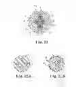 Fig. 08 - Medical devices including polyisobutylene based polymers and derivatives thereof