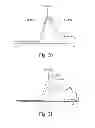 Fig. 14 - Medical devices including polyisobutylene based polymers and derivatives thereof