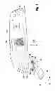 Fig. 02 - Hand-held machine tool comprising a clamping collar
