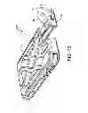 Fig. 14 - PROTECTIVE CASES AND METHODS OF MAKING