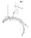 Fig. 05 - Distal shield for packaged guidewire