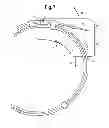 Fig. 07 - Distal shield for packaged guidewire