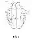 Fig. 10 - CARRYING CASE AND METHODS OF USE THEREOF