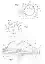 Fig. 02 - Method of arranging a buoyancy system on an aircraft, a buoyancy system for an aircraft, and an aircraft