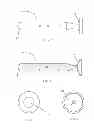 Fig. 04 - VALVES AND PUMPS USING SAID VALVES