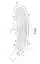 Fig. 05 - Hockey stick