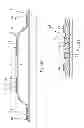 Fig. 03 - Annular barrier with external seal