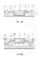 Fig. 04 - Annular barrier with external seal
