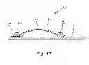 Fig. 12 - Annular barrier with external seal