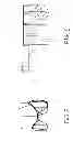 Fig. 05 - Rollable log cart