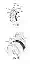 Fig. 10 - Vehicle seat