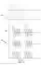 Fig. 06 - High frequency induction lighting