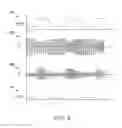 Fig. 08 - High frequency induction lighting