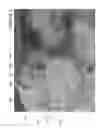 Fig. 04 - Line depth augmentation system and method for conversion of 2D images to 3D images