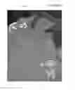 Fig. 07 - Line depth augmentation system and method for conversion of 2D images to 3D images
