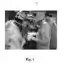 Fig. 02 - Wireless surgical loupe