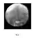 Fig. 07 - Image Processing