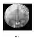 Fig. 08 - Image Processing