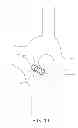 Fig. 11 - Moving body detection device and moving body detection method