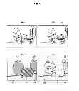 Fig. 10 - Device and method for detecting moving objects