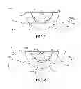 Fig. 02 - Light-emitting device with light guide for two way illumination