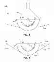 Fig. 04 - Light-emitting device with light guide for two way illumination