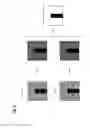 Fig. 03 - Method and device for correcting artefacts during X-ray imagery, especially computer tomography, with a moving modulator field
