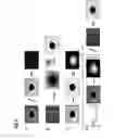 Fig. 07 - Method and device for correcting artefacts during X-ray imagery, especially computer tomography, with a moving modulator field