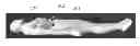 Fig. 01 - METHOD AND SYSTEM FOR GATED RADIATION THERAPY