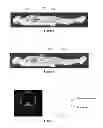 Fig. 04 - METHOD AND SYSTEM FOR GATED RADIATION THERAPY