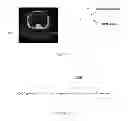 Fig. 05 - METHOD AND SYSTEM FOR GATED RADIATION THERAPY