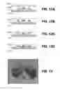 Fig. 10 - CHANNELING X-RAYS